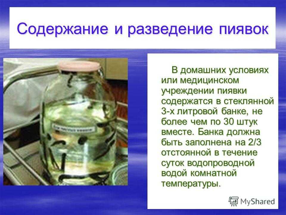 Пиявки В Омске Купить Медицинские В Аптеке