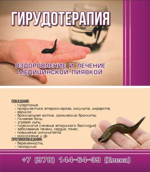 Разведение пиявок: бизнес-идея, как открыть, вложения, оборудование, что нужно для открытия + реальные кейсы